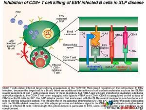 Inhibition of CD8 T cell killing of EBV infected B cells in XLP disease