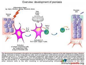 Overview development of psoriasis