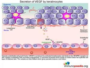 Secretion of VEGF by keratinocytes