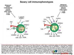 Sezary cells immunophenotypes