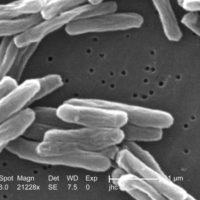 tuberculosis