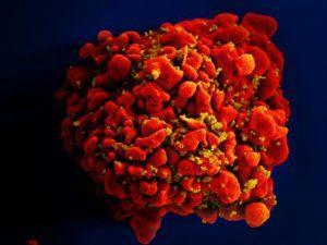 T cell infected with HIV