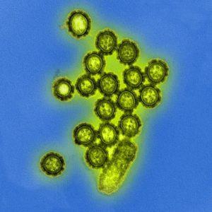 H1N1 Influenza Particle