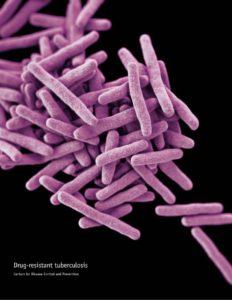mycobacterium tuberculosis