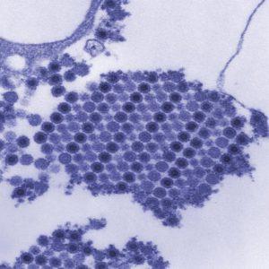 chikungunya virus particles