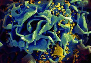 HIV infected T cell