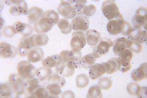 Plasmodium falciparum