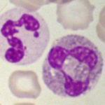 Neutrophil in blood smear