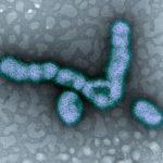 H1N1 influenza virus particles