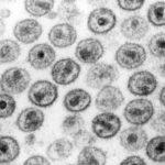 Transmission electron micrograph of HIV