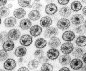 Transmission electron micrograph of HIV