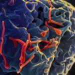 Ebola virus budding from cell