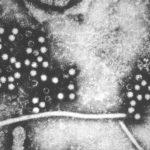 Hepatitis E Virus