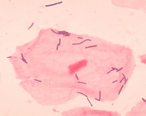 Lactobacillus organisms from vaginal smear (Janice Carr, CDC/Dr. Mike Miller, Centers for Disease Control and Prevention's Public Health Image Library (PHIL))