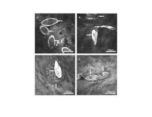 confocal images of Schistosoma eggs