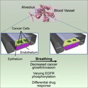 Lung on chip cancer model