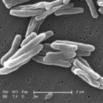 EM of Mycobacterium tuberculosis (Janice Carr, WIkimedia Commons)
