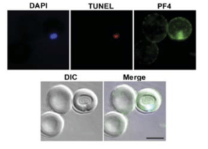 Koh et al., 2018 Fig 3I: Micrographs showing a PF4+TUNEL+ P. knowlesi infected cell after platelet treatment. Scale bars = 5 μm. Images were taken at 630x magnification on an Axio Observer inverted fluorescence microscope coupled to an Axiocam 503 monochrome camera with ZEN 2 software (Carl Zeiss, Germany). Bars indicate means of replicate data points. Abbreviation: DIC, differential interference contrast.