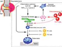 Regulation of osteoclast differentiation in Rheumatoid arthritis: Upregulation of proinflammatory cytokines activates osteoclastogenesis. Kazuo Okamoto and Hiroshi Takayanagi, 2011,Arthritis Research and Therapy.