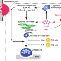 Regulation of osteoclast differentiation in Rheumatoid arthritis: Upregulation of proinflammatory cytokines activates osteoclastogenesis. Kazuo Okamoto and Hiroshi Takayanagi, 2011,Arthritis Research and Therapy.