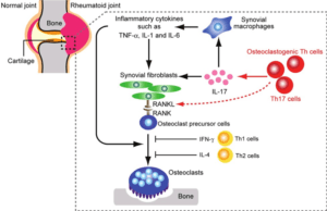 Regulation of osteoclast differentiation in Rheumatoid arthritis: Upregulation of proinflammatory cytokines activates osteoclastogenesis. Kazuo Okamoto and Hiroshi Takayanagi, 2011,Arthritis Research and Therapy.