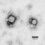 Methylamine tungstate negative-stain electron micrograph of arenavirus isolated from mouse spleen homogenate cultures that tested positive by immunofluorescence assay for lymphocytic choriomeningitis virus infection. Viral envelope spikes and projections are visible, and virion inclusions show a sandy appearance, indicating Arenaviridae. (Source: Foster et al., 2006 Emerg Infect Dis)
