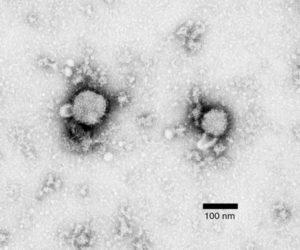  Methylamine tungstate negative-stain electron micrograph of arenavirus isolated from mouse spleen homogenate cultures that tested positive by immunofluorescence assay for lymphocytic choriomeningitis virus infection. Viral envelope spikes and projections are visible, and virion inclusions show a sandy appearance, indicating Arenaviridae. (Source: Foster et al., 2006 Emerg Infect Dis)
