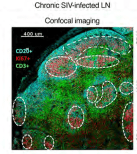 A representative confocal image of follicular cells from 1 chronically SIV-infected animal. Germinal centres (GC) were defined by CD20+Ki67+ coexpression, and CD4+ (CD3+CD4+) and CD8+ (CD3+CD4–) T cells were quantified within each GC. Scale bar: 400 μm. (Source Ferrando-Martinez et al., 2018)