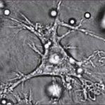 Dendritic Cell. Source Wikipedia: Judith Behnsen, Priyanka Narang, Mike Hasenberg, Frank Gunzer, Ursula Bilitewski, Nina Klippel, Manfred Rohde, Matthias Brock, Axel A. Brakhage, Matthias Gunzer - Source: PLoS Pathogens - http://pathogens.plosjournals.org/perlserv/?request=get-document&doi=10.1371/journal.ppat.0030013