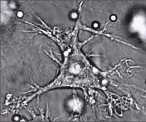 Dendritic Cell. Source Wikipedia: Judith Behnsen, Priyanka Narang, Mike Hasenberg, Frank Gunzer, Ursula Bilitewski, Nina Klippel, Manfred Rohde, Matthias Brock, Axel A. Brakhage, Matthias Gunzer - Source: PLoS Pathogens - http://pathogens.plosjournals.org/perlserv/?request=get-document&doi=10.1371/journal.ppat.0030013