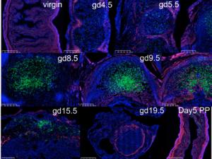 Time course of GFP+ cells accu- mulating in Ncr1iCre 3 RosamT/mG dams during pregnancy. (A) The uteri of pregnant Ncr1iCre 3 RosamT/mG reporter mice were prepared for his- tology at the indicated gd.