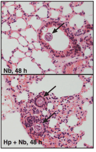 Figure 1d: Representative H&E stained sections of lung from 48 h post Nb infection. Cross-sections of larvae are indicated with an arrow. Filbey et al., 2018