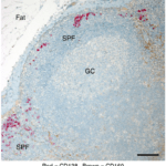 c Representative immunohistochemical analysis of draining cervical lymph node from a patient with head and neck cancer showing CD169 (brown) and CD138 (red) expression. Hematoxylin nuclear counterstain (blue). Scale bar =100μm (Source Moran et al., 2018 Fig. 7c)