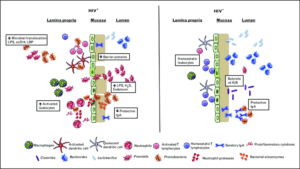 Microbial dysbiosis in HIV is characterized by decreased abundances of Bacteroides, Lactobacillus and beneficial clostridia with increased abundances of Prevotella and pathogenic Proteobacteria, increasing T-cell and DC activation. Loss of secretory IgA may help to explain the outgrowth of pathogenic bacteria. Increased neutrophil and macrophage accumulation in the lamina propria, bacterial activity in the mucosa, and other mechanisms destabilize the mucosa and GI epithelium, leading to MT and further accumulation of inflammatory microbial products and cytokines in circulation. Together, these mechanisms perpetuate an inflammatory cycle that leads to chronic immune activation in ART-treated HIV-infected individuals. ART, antiretroviral therapy; DC, dendritic cell; GI, gastrointestinal; LPS, lipopolysaccharide; MT, microbial translocation. Source: Lyle-Mckinnon et al., 2015. 