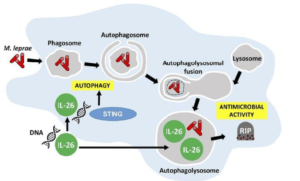 Graphical abstract demonstrating the antimicrobial activity of IL-26 against intracullar bacteria like M.leprae: IL-26 is able to colocalize with M.leprae in infected human monocyte-derived-macrophages. IL-26 may also promotes intracellular killing by promoting phagolysosomal fusion. By binding to the DNA of dead cells, IL-26 allows the cytoplasmic DNA receptor STING to bring about autophagy. (Source: Dan et al., JCI 2019)