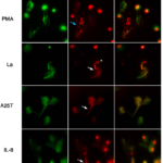 Live-cell imaging of NET formation in two different channels for up to 120 minutes. SYTOX Green at 10 nM was used for NET detection (depicted in green; left panels), and a TYE™-665 labeled hsa-miR142-3p locked nucleic acid (LNA) detection probe at 5 μM for miR-142-3p detection (depicted in red; middle panels). The hsa-miR-142-3p staining was present in two different morphological patterns: one shows a strong staining (asterisk), and the other reveals a weak staining that can be either punctate (blue arrow) or diffuse (white arrows). The right panels show the merge of the two channels. Bars: 20 μm. (Source: Linhares-Lacerda et al., 2020)