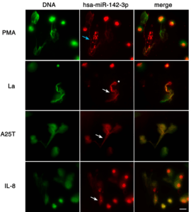 Live-cell imaging of NET formation in two different channels for up to 120 minutes. SYTOX Green at 10 nM was used for NET detection (depicted in green; left panels), and a TYE™-665 labeled hsa-miR142-3p locked nucleic acid (LNA) detection probe at 5 μM for miR-142-3p detection (depicted in red; middle panels). The hsa-miR-142-3p staining was present in two different morphological patterns: one shows a strong staining (asterisk), and the other reveals a weak staining that can be either punctate (blue arrow) or diffuse (white arrows). The right panels show the merge of the two channels. Bars: 20 μm. (Source: Linhares-Lacerda et al., 2020)