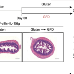 DQ8-Dd-villin-IL-15tg mice were maintained on a gluten-free diet (GFD; sham), fed gluten for 60 days (gluten), or fed gluten for 30 days and then reverted to a GFD (gluten→GFD) for 30 days. a, Experimental timeline. b, Left, haematoxylin and eosin (H&E) staining of paraffin-embedded ileum sections. Scale bars, 200 μm. Right, graph depicts the ratio of the morphometric assessment of villus height to crypt depth (GFD, n = 9; gluten, n = 13; gluten→GFD, n = 11 mice). c, Serum levels of anti-DGP IgG antibodies were measured by ELISA. Serum was collected sequentially in the same mice (n = 12) before gluten feeding (untreated), 30 days after gluten feeding (gluten d30), and 30 days after reversion to a GFD (GFD d60). (Source Abadie et al., 2020)