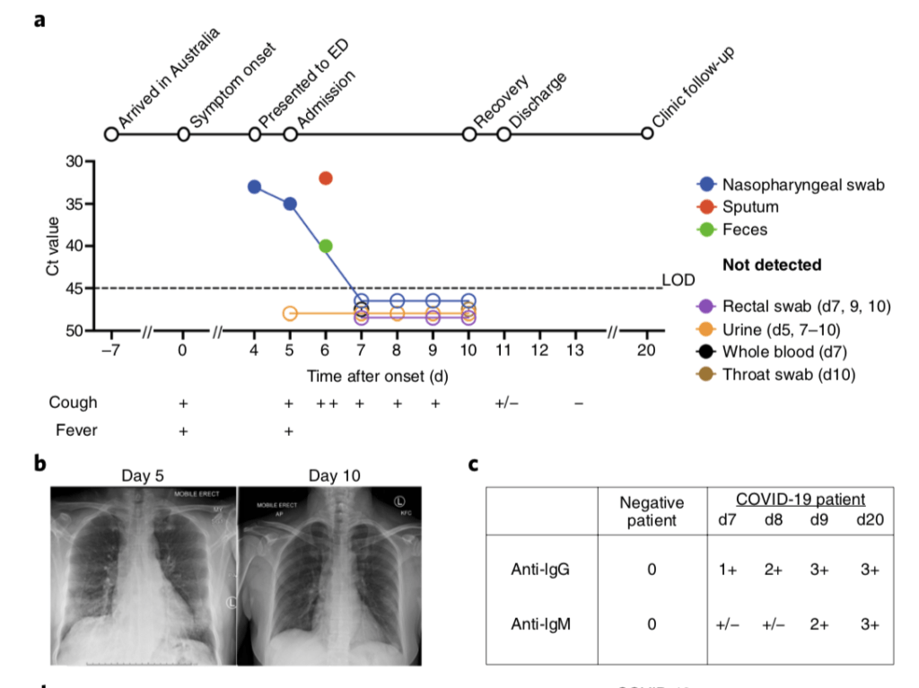 of Immune Response in a Mild COVID19 Patient Immunopaedia