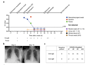 a, Timeline of COVID-19, showing detection of SARS-CoV-2 in sputum, nasopharyngeal aspirates and feces but not urine, rectal swab or whole blood. SARS-CoV-2 was quantified by rRT-PCR; cycle threshold (Ct) is shown. A higher Ct value means lower viral load. Dashed horizontal line indicates limit of detection (LOD) threshold (Ct = 45). Open circles, undetectable SARS-CoV-2. b, Anteroposterior chest radiographs on days 5 and 10 following symptom onset, showing radiological improvement from hospital admission to discharge. c, Immunofluorescence antibody staining, repeated twice in duplicate, for detection of IgG and IgM bound to SARS-CoV-2-infected Vero cells, assessed with plasma (diluted 1:20) obtained at days 7–9 and 20 following symptom onset. (Source: Thevarajan et al., 2020. Breadth of concomitant immune responses prior to patient recovery: a case report of non-severe COVID-19. Nature Medicine.)