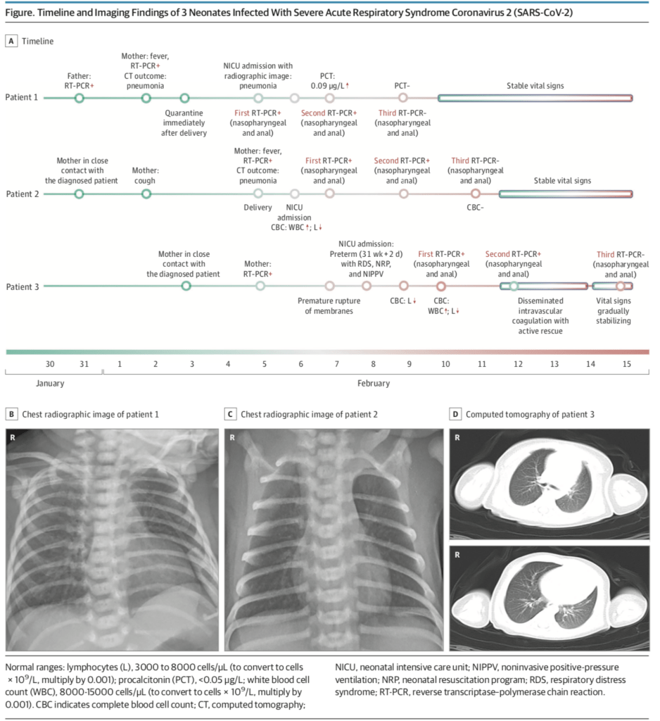 Can neonates born to mothers with COVID19 acquire maternal infection
