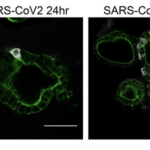 (a) Immunofluorescent staining of SARS-CoV-2-infected intestinal organoids. Nucleoprotein (NP) stains viral capsid. After 24 hours, single virus-infected cells are generally observed in organoids. These small infection clusters spread through the whole organoid after 60 hours. (Source: Lamers et al., 2020)