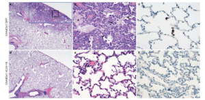 Histological changes in lungs of rhesus macaques on 7 days post infection. a) Focal interstitial 138 pneumonia in lungs of a control animal (blue box). The area in the black box is magnified in 139 panel b. b) Interstitial pneumonia with edema (asterisk), type II pneumocyte hyperplasia 140 (arrowhead) and syncytial cells (arrow) in control animals. c) SARS-CoV-2 antigen (visible as 141 red-brown staining) was detected by immunohistochemistry in type I and type II pneumocytes in 142 the lungs of control animals. d) No histological changes were observed in the lungs of ChadOx1 143 nCoV-19-vaccinated animals. e) Higher magnification of lung tissue in panel d. No evidence of 144 pneumonia or immune-enhanced inflammation is observed. f) No SARS-CoV-2 antigen was 145 detected by immunohistochemistry in the lungs of vaccinated animals. Magnification: panels a, d 146 40x; panels b, c, e, f 400x.(Source van Doremalen et al., 2020)
