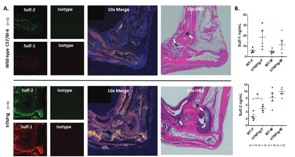 Novel protein linked to rheumatoid arthritis pathogenesis Immunopaedia