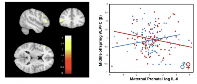 Prenatal Immune Activity and Sex Differences in Brain Development: A ...